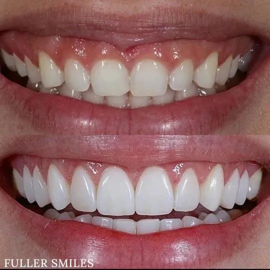 The image displays three close-up photos of a smiling person showcasing their teeth, with a focus on dental care services such as teeth whitening, straightening, and alignment.