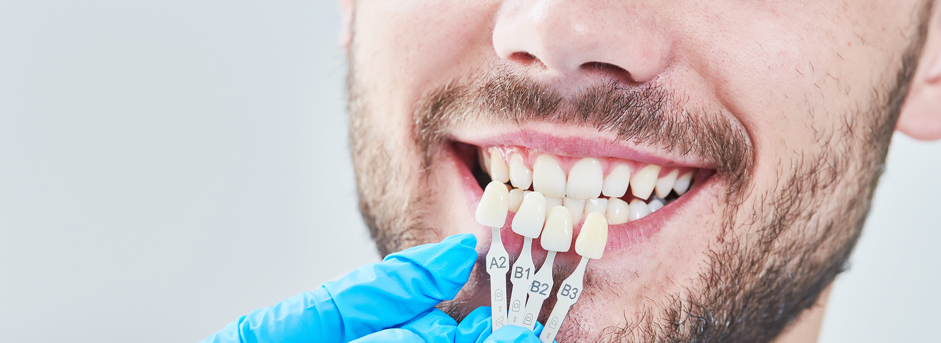 The image shows a person with a large smile, holding up their teeth for examination with dental instruments.